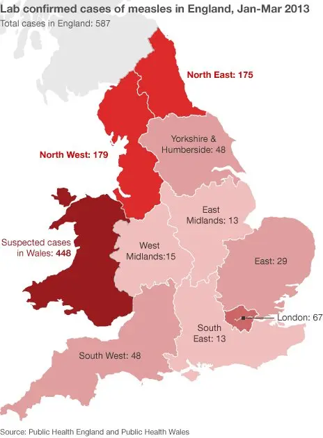 Map: Lab Confirmed Cases of Measles in the Current UK Outbreak